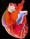 B0005637 Enhanced image of a human heart